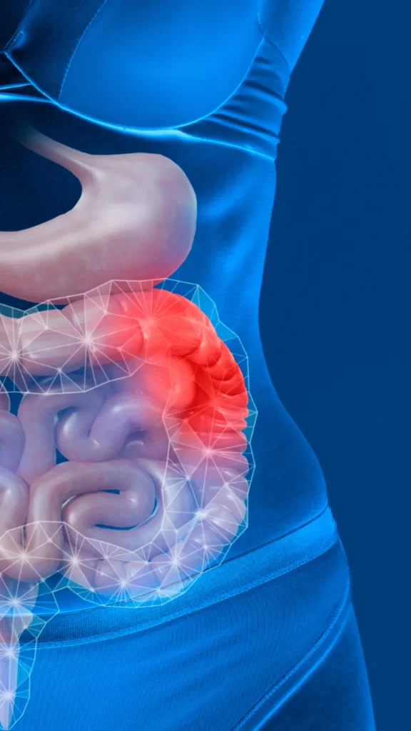 Desvendando Distúrbios Digestivos Desvendando Distúrbios Digestivos